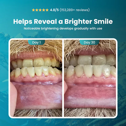 nulooa™ Detox Toothpaste | 1+1 Gratis!