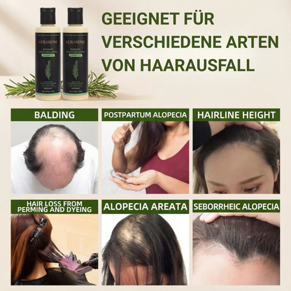nulooa™ Rosemary Shampoo | 1+1 Gratis!