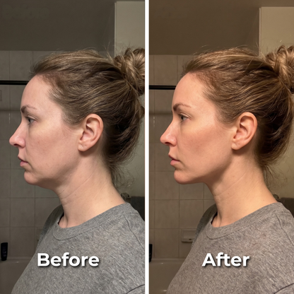 nulooa™  GlowLift  | 1+1 Gratis!