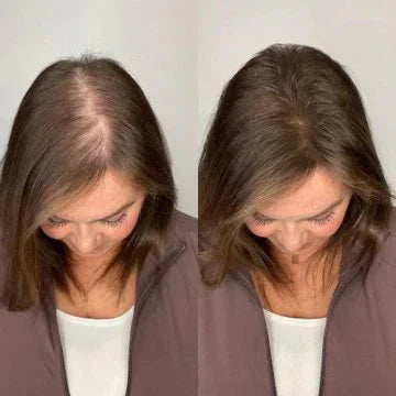 nulooa™ Rosemary Shampoo | 1+1 Gratis!