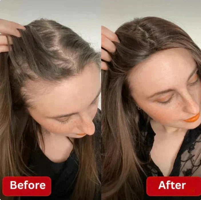 nulooa™ Rosemary Shampoo | 1+1 Gratis!