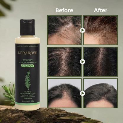 nulooa™ Rosemary Shampoo | 1+1 Gratis!